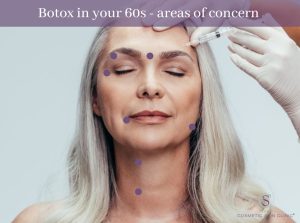 What age to get Botox - Preventative Botox - Botox 20s, 30s, 40s, 50s ...