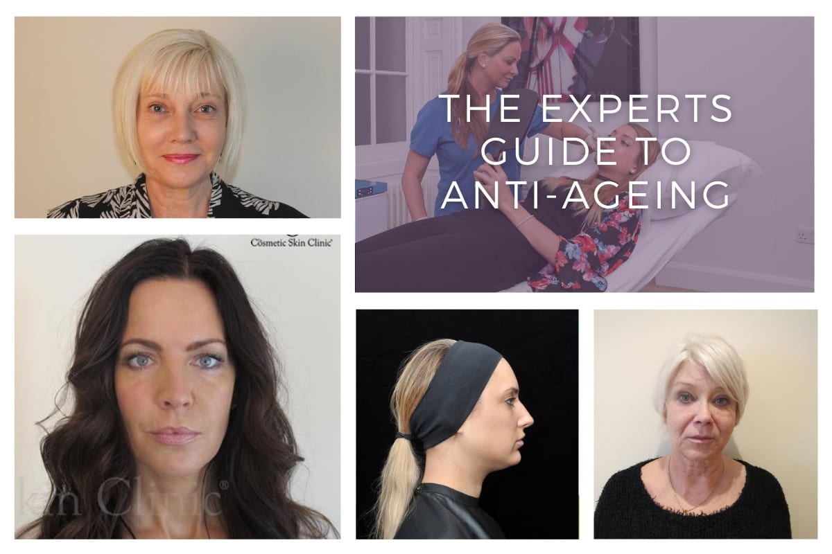 The Experts' Guide To Anti-Ageing - 30s, 40s, 50s, 60s & Beyond - The  Cosmetic Skin Clinic