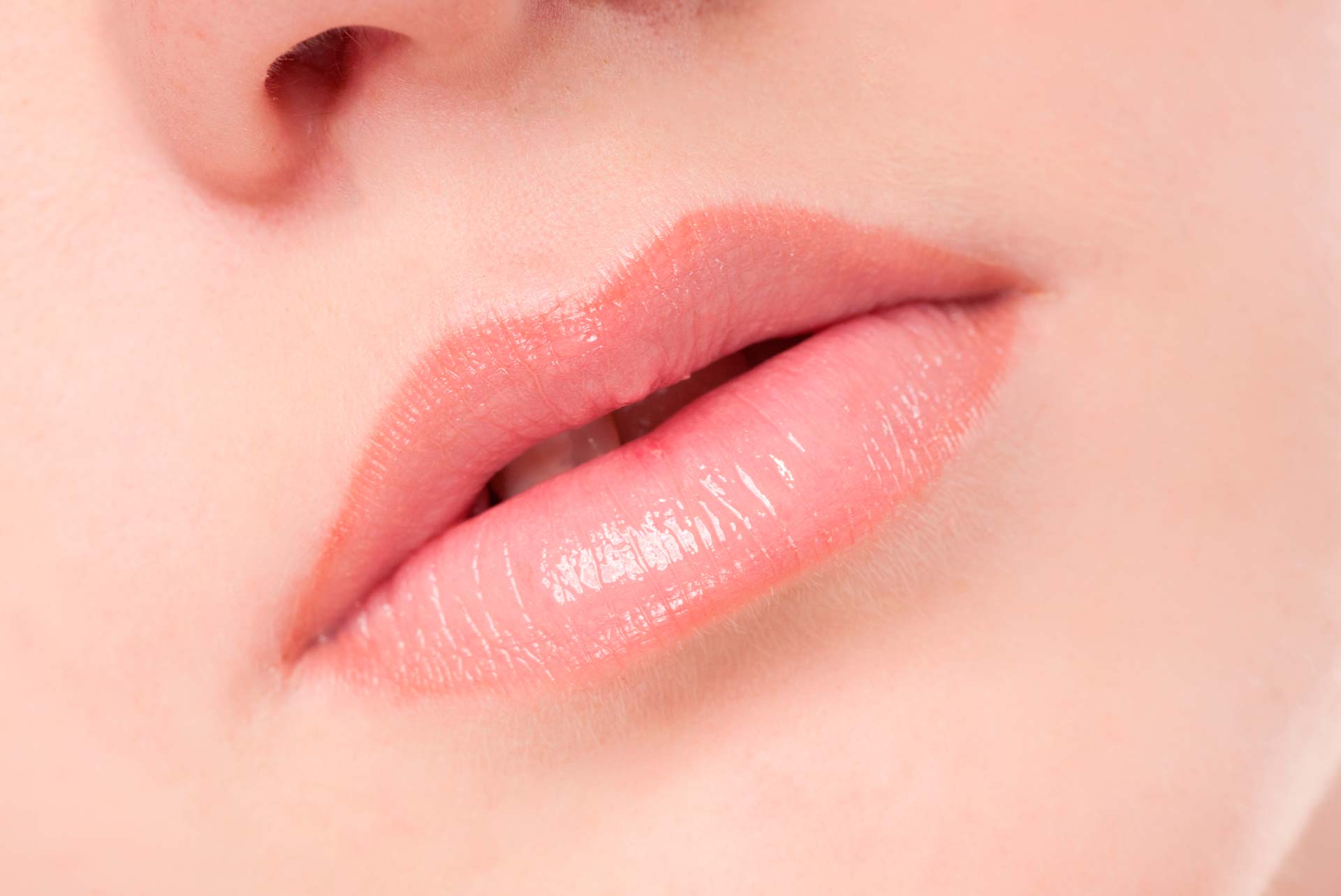 What Can Be Done About Lip Wrinkles Lines On Lips Best Non Surgical 