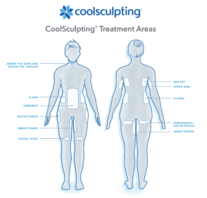 CoolSculpting Treatment Areas